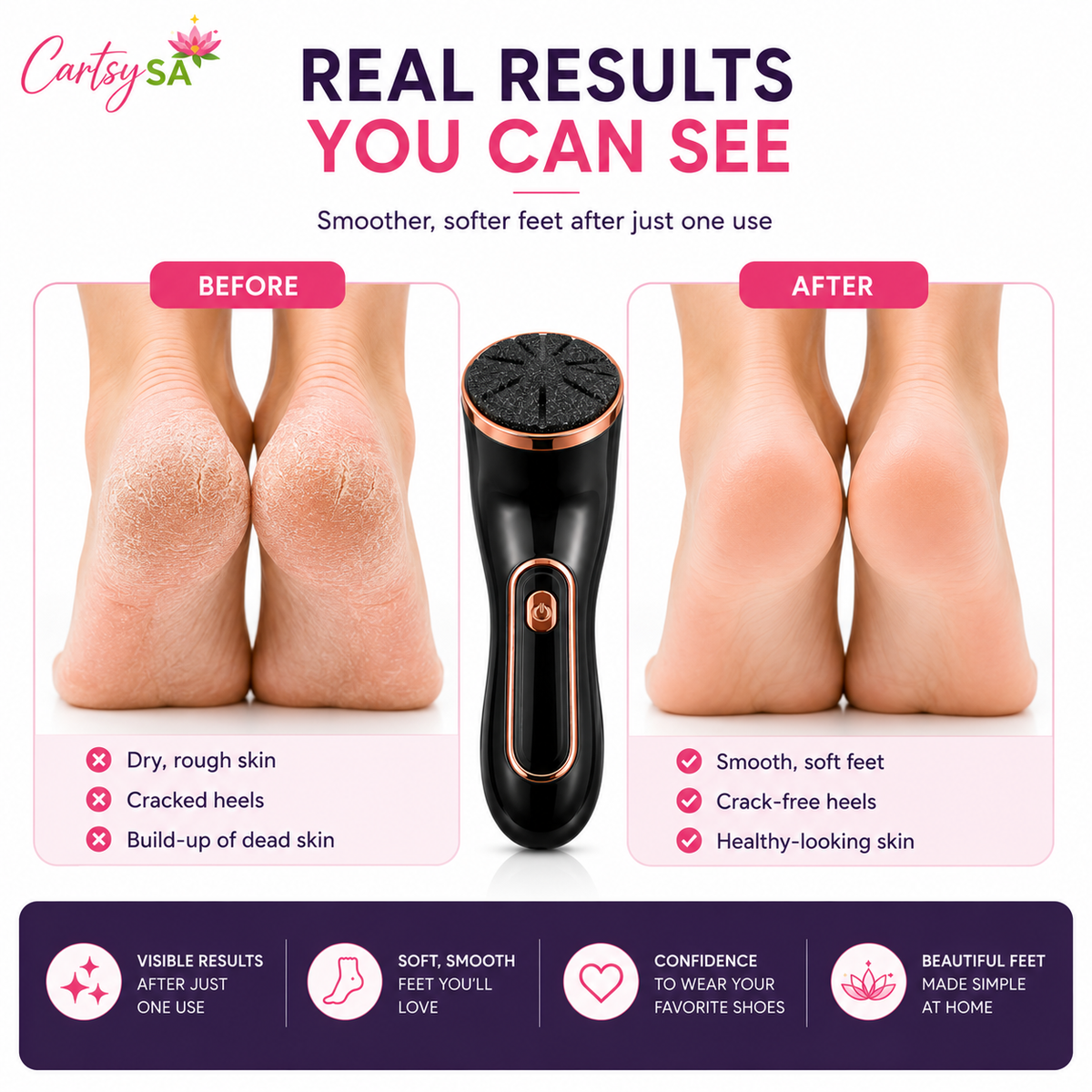 CartsySA™ Electric Foot Callus Remover