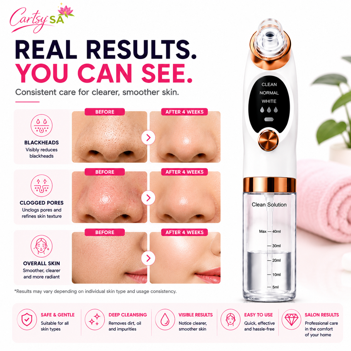 CartsySA™ Pore Vacuum Blackhead Remover