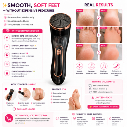 CartsySA™ Electric Foot Callus Remover