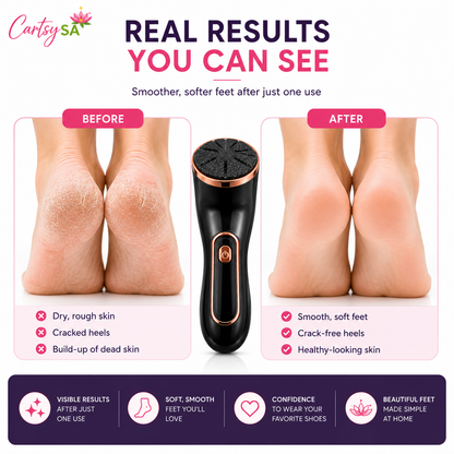 CartsySA™ Electric Foot Callus Remover