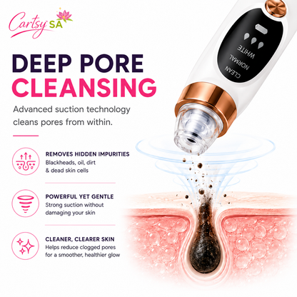CartsySA™ Pore Vacuum Blackhead Remover