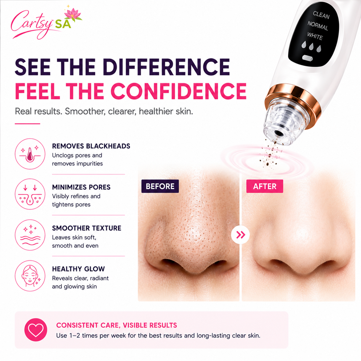 CartsySA™ Pore Vacuum Blackhead Remover