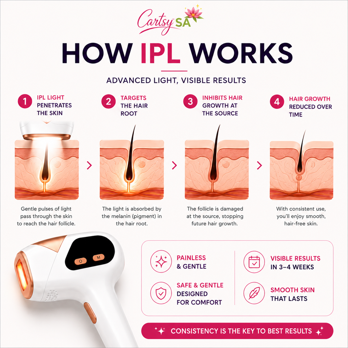 CartsySA™ IPL Hair Removal Device