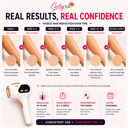 CartsySA™ IPL Hair Removal Device