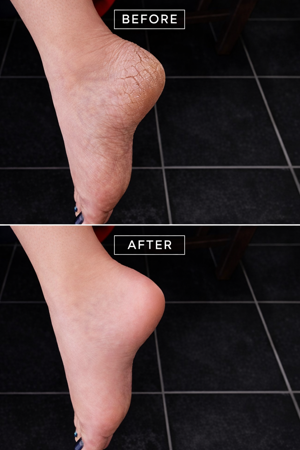 ✨CartsySA™ Electric Foot Callus Remover